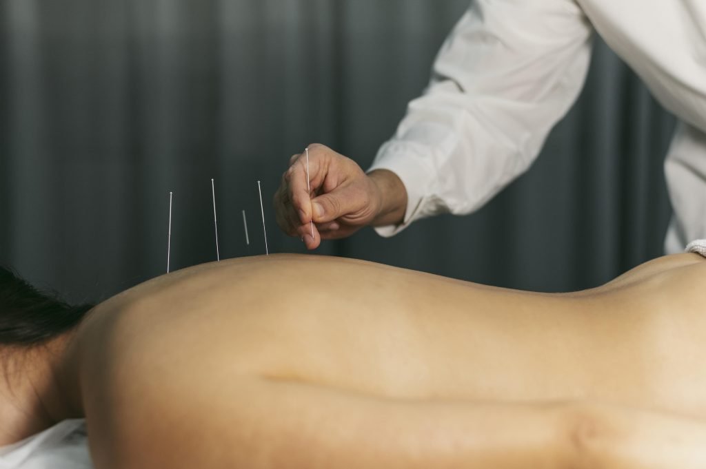Acupuncturist in Alphen Aan Den Rijn